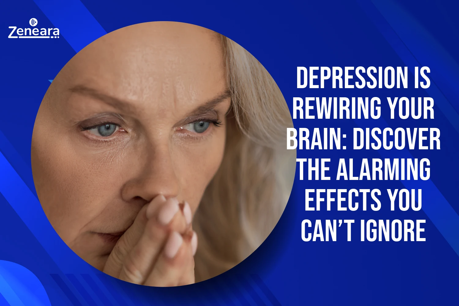 Depression is Rewiring Your Brain