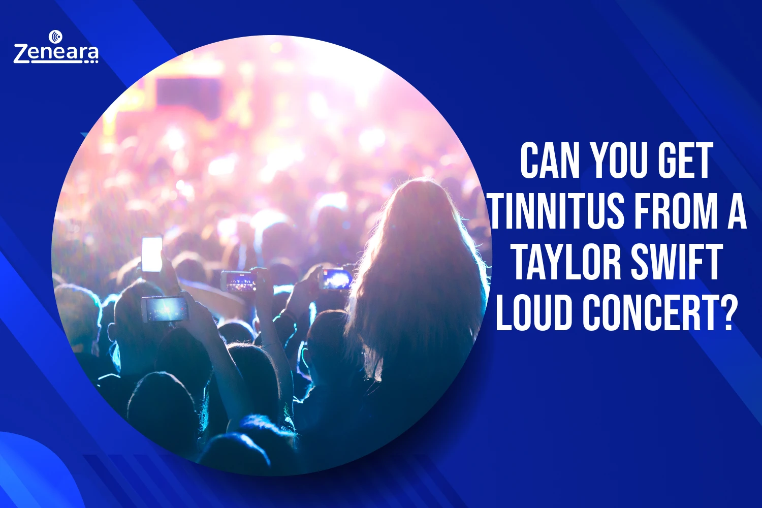 Can You Get Tinnitus From a Taylor Swift Loud Concert